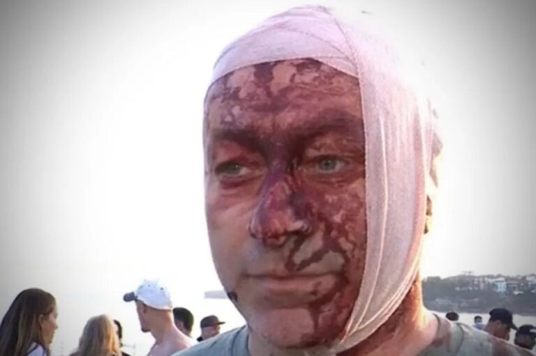 هل كان من الممكن منع مذبحة شاطئ بوندي؟