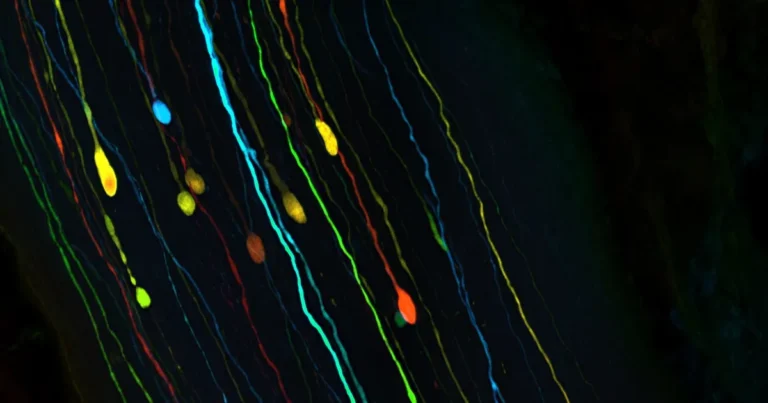 باحثون يتوصلون لأسباب تعافي الجهاز البصري بعد إصابات الدماغ